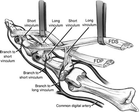 Flexor Tendon Injuries - Hand - Orthobullets