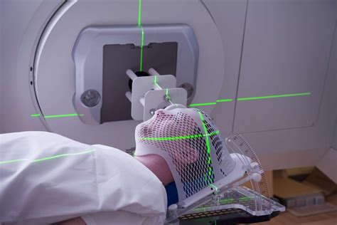 Radioterapia paliativa como tratamiento para el cáncer - Medicina Básica