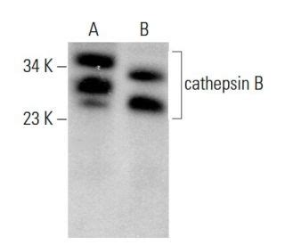 cathepsin B Antibody (H-5) | SCBT - Santa Cruz Biotechnology