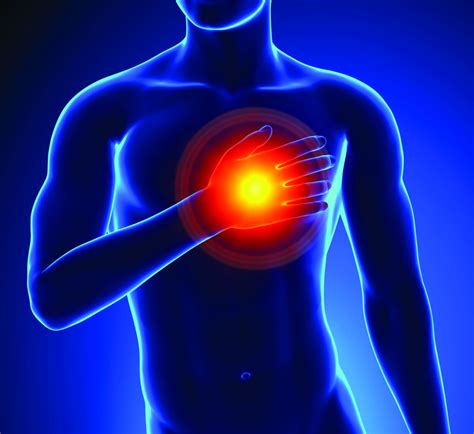 When is a troponin elevation an acute myocardial infarction? | The ...