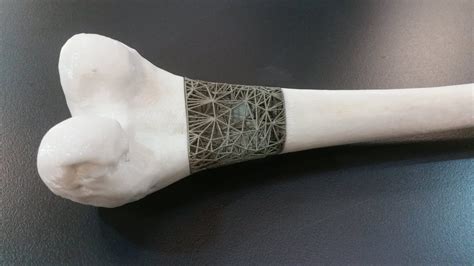 Doctors Plan to 3D Print Bone Implants Mid-Surgery | All3DP