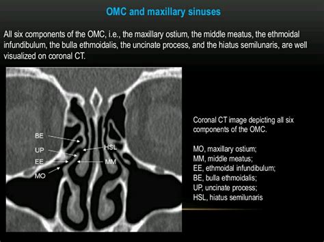 Componrnts of OMC - hiatus semilunaris is the space between the ...