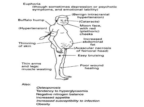 PREVENTION & MANAGEMENT OF SIDE EFFECTS OF SYSTEMIC STEROIDS