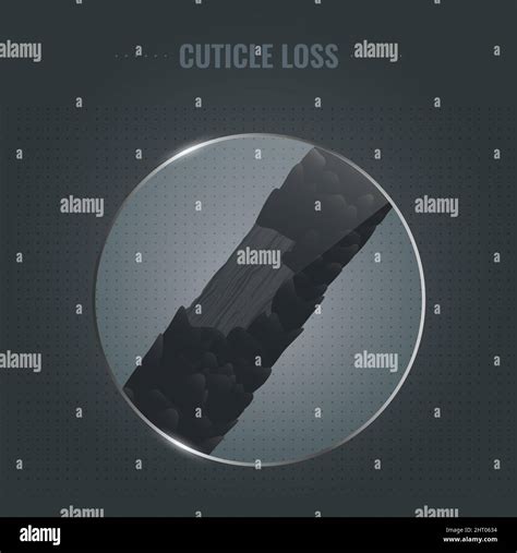 Damaged hair cuticle loss, illustration Stock Photo - Alamy