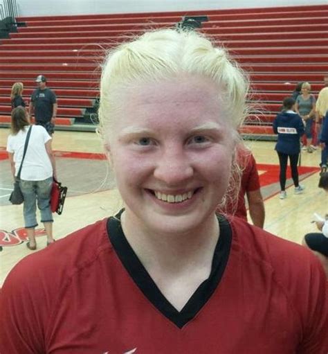 Mya Lynn Lesnar: The Albino Athlete Destined for Sports Success