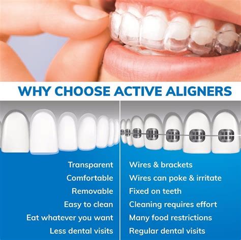 Active Aligners - Affordable alternative to traditional braces ...