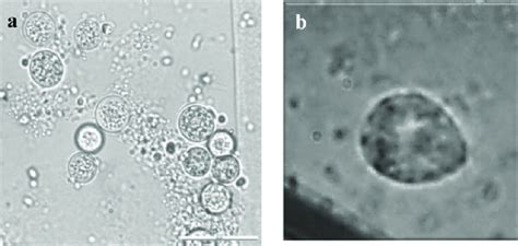 Morphology of ciliates observed. (a) Ciliates in cysts state and (b ...