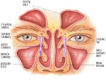 Nose & Sinus Infections (Sinusitis) | The Ear Nose Throat - Head & Neck ...