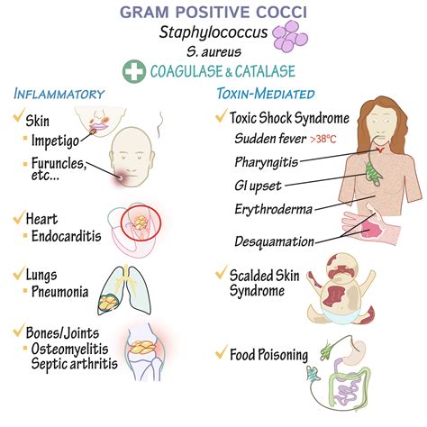 Immunology/Microbiology Glossary: Gram-Positive Cocci - Overview | Draw It to Know It