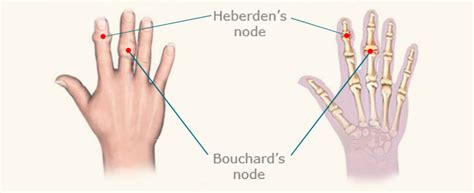 Finger Nodes