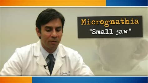 Micrognathia and neonatal mandibular distraction - The Doctor's Channel ...