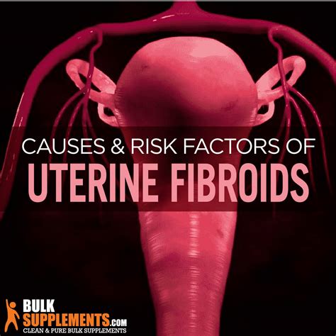 What are Uterine Fibroids? Symptoms, Causes & Treatment