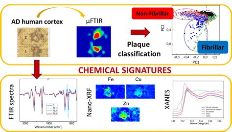 Characterising amyloid plaques in Alzheimer’s disease