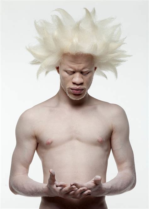 1000+ images about albino the beautiful on Pinterest