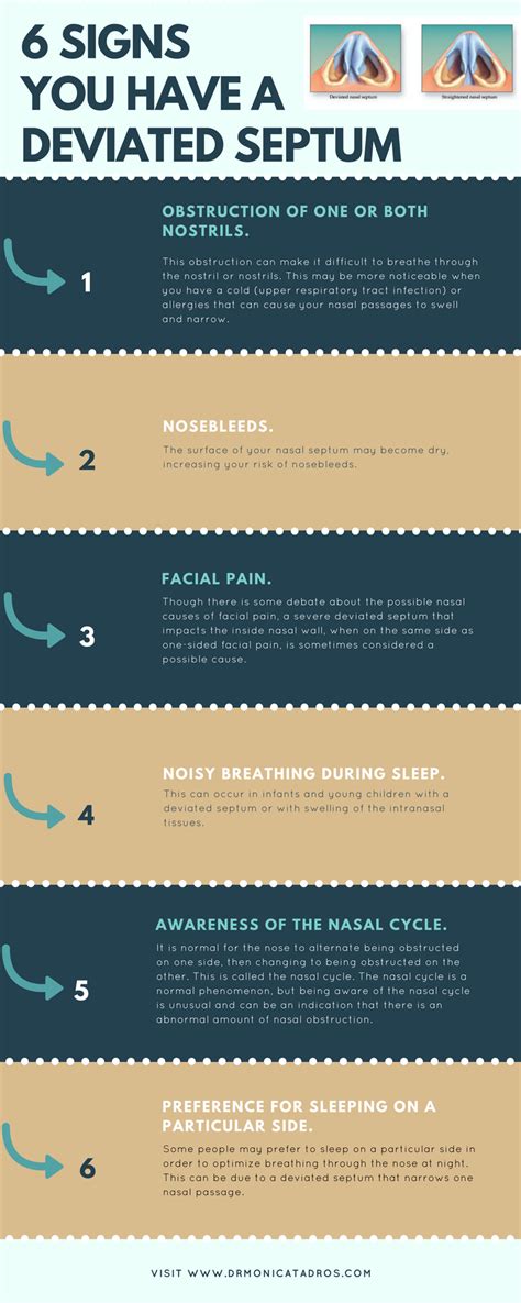 6 signs you have a deviated septum [Infographic]