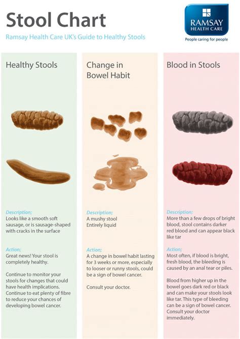 Bowel cancer symptoms: Bad smell poo sign of healthy stool | Express.co.uk