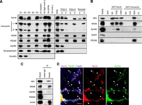 Numb associates with EphB2 and NMDA receptors at dendritic spines. (A)... | Download Scientific ...