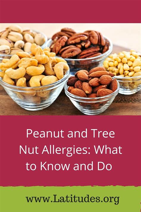 are pine nuts tree nuts allergy - Tracey Salgado