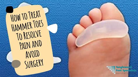 Treating Hammer Toes Without Surgery | Hammer Toe Pads