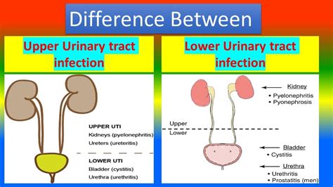 Upper Urinary tract infection Vs. Lower Urinary tract infection - YouTube