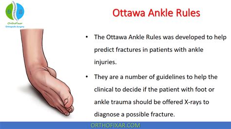 Ottawa Ankle Rules • Easy Explained - OrthoFixar 2022 (2022)