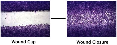 Wound Healing Assay (ab242285) | Abcam