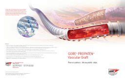 Resource Library for GORE® PROPATEN® Vascular Graft | Gore Medical