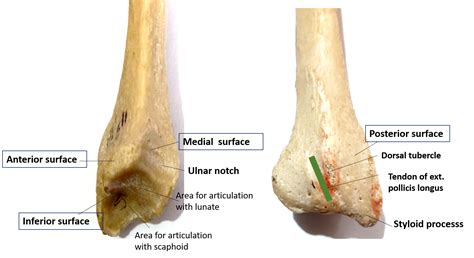 Radius - Anatomy QA