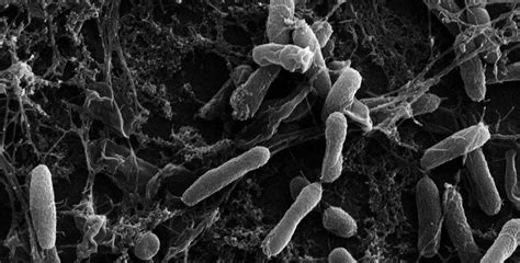 “Stressed-Out Bacteria Provide Insights to Antibiotic Resistance - Mirage News” plus 1 more