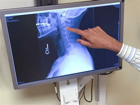 Barium Swallow: What to Expect, Side Effects, and Cost