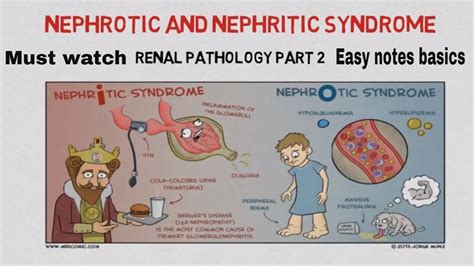 Nephrotic and nephritic syndrome - Causes , introduction EASY NOTES - YouTube