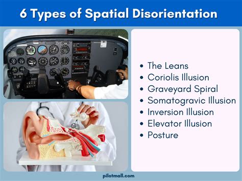 Dangers Of Spatial Disorientation (Causes, Symptoms, Prevention)