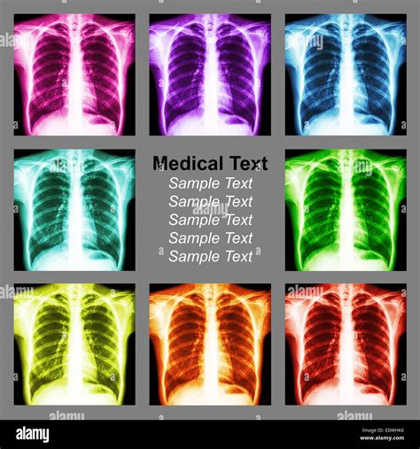 Multicolored chest x-ray background Stock Photo - Alamy