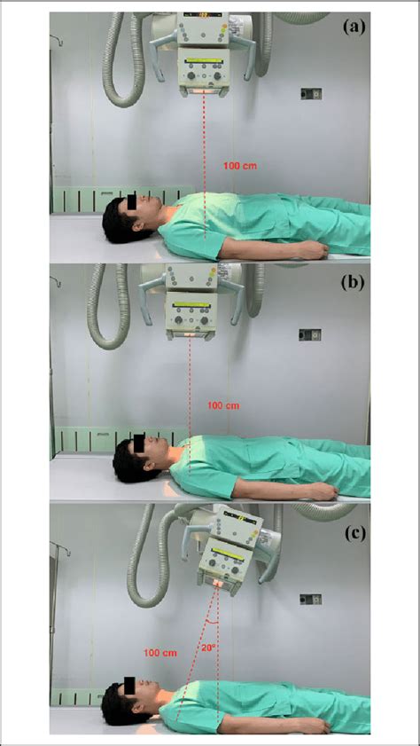 Three radiographs, including (a) chest AP, (b) both clavicle AP, and... | Download Scientific ...