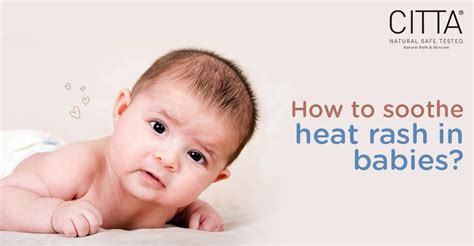 How to treat heat rash in babies? - CITTA