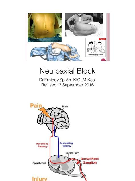 Regional Anesthesia | PDF | Anesthesia | Clinical Medicine