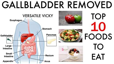 10 Gallbladder Foods | Foods To Eat After GallBladder Removal / Surgery - YouTube | Gallbladder ...