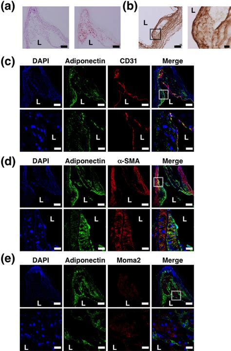 Apolipoprotein E knockout (ApoE-KO) mice were fed high-fat atherogenic ...