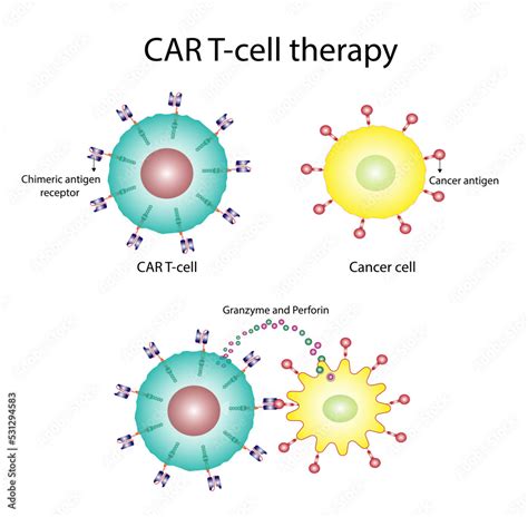 CAR T-cell therapy and Cancer treatment . Cancer therapy. CAR T cells ...