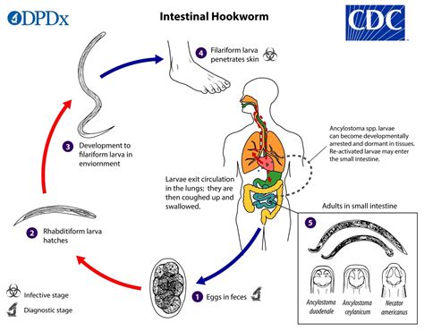 Hookworm infection: life cycle, transmission, pathogenesis, diagnosis ...