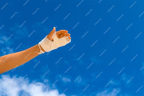 Premium Photo | Broken hand in white cast on blue sky background with ...