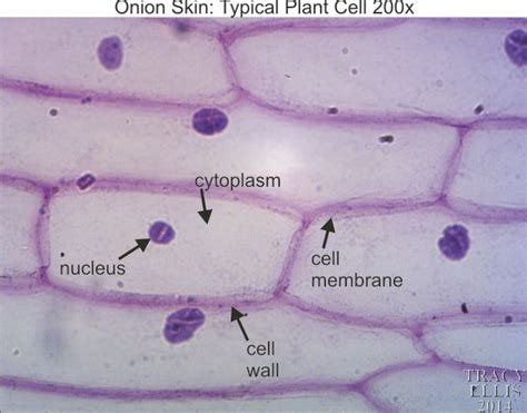 Onion skin 200x - Dissection Connection