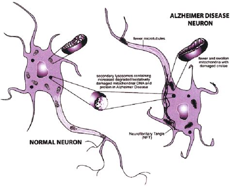 Mitochondrial abnormalities in Alzheimer ’ s disease likely contribute ...