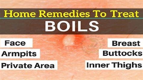 What causes a boil on your back: Boils: Causes, Symptoms, Treatment, Prevention