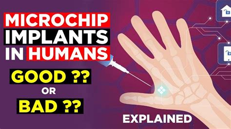 Microchip Implant In Humans - Is Microchip Implantation in Human Body Safe? - EXPLAINED (2019) 🔥 ...