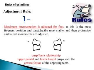 occlusal adjustment | PPT