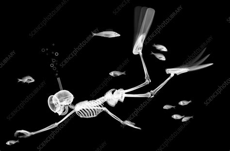 Skeleton diving amongst fish, X-ray - Stock Image - F030/9767 - Science Photo Library