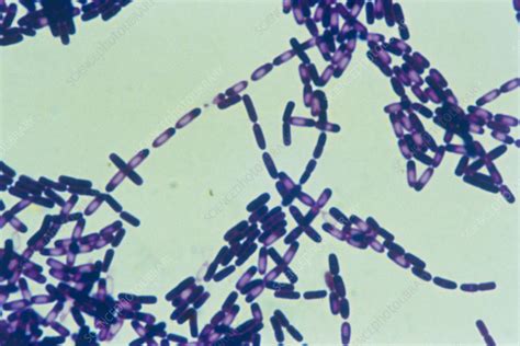 Colony of Bacillus subtilis bacteria - Stock Image - B220/0203 - Science Photo Library