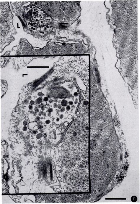 Two nerve endings where most of the vesicles contain dense material.... | Download Scientific ...