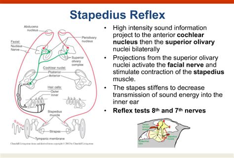 The stapedius reflex. The stapedius m. will contract, stabilizing the stapes and preventing ...